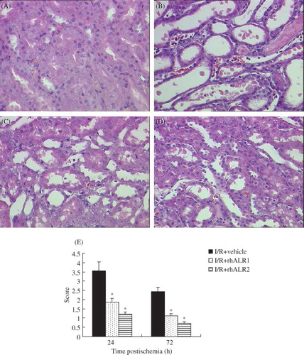 Figure 2. Effects of rhALR on I/R-induced renal injury. Representative hematoxylin-eosin-stained renal sections from sham-operated (A) and vehicle- (B), rhALR1- (C), and rhALR2-treated (D) rats at 24 h, demonstrating more severe lesions of tubular necrosis in I/R rats. RhALR1 and rhALR2 treatment significantly preserved renal tissue morphology. Magnification ×400. Semiquantitative assessment of histological lesions based on tubular necrosis.Notes: Values represent mean scores ± SD. *Denotes p < 0.05 versus the I/R+vehicle group.
