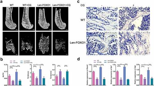 Figure 5. The role of FOXO1-mediated autophagy in bone formation. (a) three-dimensional reconstruction of distal femur by Micro-CT. Scale bar = 200 μm. (b) micro-CT measurement ofbone volume per total volume (BV/TV), the mean trabecular number (Tb.N) and the mean trabecular separation (Tb.Sp). (C) Immunohistochemical staining of RUNX2 in distal femur. Scale bar = 25 μm. (d) quantitative analysis for mRNA expressions of runt-related transcription factor 2 (Runx2), Sp7 and alkaline phosphatase (Alpl) by real-time qPCR. Data are presented as means ± SD, n = 3–6 specimens/group, *p < 0.05, **p < 0.01, ***p < 0.001, ****p < 0.0001.