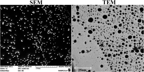 Figure 1 Physical characterisation of gold nanoparticles. Scanning electron microscopy images of gold nanoparticle (scale bar: 250 nm) and transmission electron microscopy (scale bar: 25 nm).