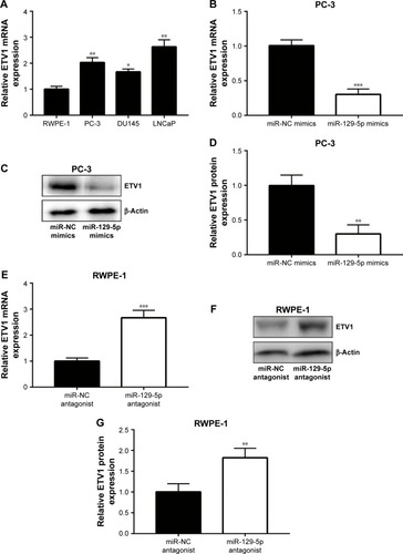 Figure 3 ETV1 was negatively regulated by miR-129-5p.Notes: (A) In comparison with normal epithelial prostate cell line RWPE-1, expression of ETV1 mRNA was reduced in prostate cancer cell lines (PC-3, DU145, and LNCaP). (B) MiR-129-5p mimics decreased ETV1 mRNA expression in PC-3 cells. (C) MiR-129-5p mimics decreased ETV1 protein expression in PC-3 cells. (D) Quantitative analysis of ETV1 protein expression in (C). (E) MiR-129-5p antagonist increased ETV1 mRNA expression in RWPE-1 cells. (F) MiR-129-5p antagonist increased ETV1 protein expression in RWPE-1 cells. (G) Quantitative analysis of ETV1 protein expression in (F). *P<0.05, **P<0.01, ***P<0.001.