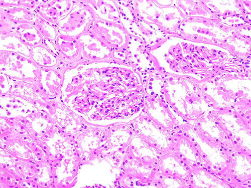 Figure 1 Histopathology of renal puncture in the Control Group did not change significantly (x200).