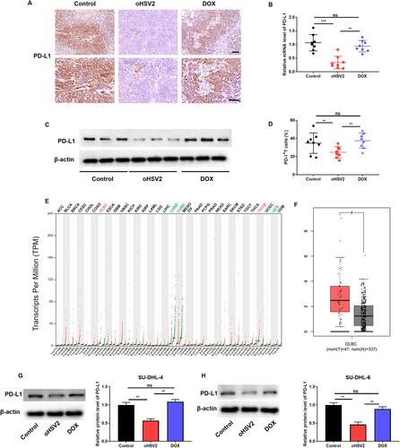Figure 4. oHSV2 can inhibit the PD-1/PD-L1 immune-checkpoint. (A) Immunohistochemical evaluation of PD-L1-positive rate in tumor tissues of mice after oHSV2 or DOX treatment, scale bar: 50 μm, n = 8. (B) RT-qPCR evaluation of PD-L1 mRNA level in tumor tissues of mice after oHSV2 or DOX treatment, non-paired t-test, n = 8. (C) Western blotting evaluation of PD-L1 protein level in tumor tissues of mice after oHSV2 or DOX treatment, n = 8. (D) Flow cytometry assessment of the percentages of PD-L + T cells in the tumor tissues of mice after oHSV2 or DOX treatment, non-paired t-test, n = 8. (E) The PD-L1 expression profile across all tumor samples and paired normal tissues (dot plot), each dots represent expression of samples. (F) Based on GEPIA database, the expression of PD-L1 in in tissues from 47 DLBCL tumor patients and 337 normal tissues, non-paired t-test. (G) Western blotting evaluation of PD-L1 protein level in SU-DHL-4 cells after oHSV2 or DOX treatment, one-way ANOVA and t-test, n = 3. (H) Western blotting evaluation of PD-L1 protein level in SU-DHL-6 cells after oHSV2 or DOX treatment, one-way ANOVA and t-test, n = 3. nsp>.05, **p<.01, ***p<.001. n = 6.