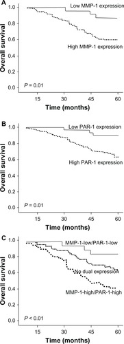 Figure 2 Kaplan–Meier survival plots of MMP-1 (A), PAR-1 (B), and MMP-1/PAR-1 (C) expression. Kaplan–Meier survival analysis revealed that the NPC patients overexpressing MMP-1 and PAR-1 proteins both exhibited markedly poorer overall survival (both P = 0.01). Regarding their combined expression, the overall survival in NPC patients with MMP-1 and PAR-1 dual overexpression was significantly shorter than those with dual low expression (P < 0.001).