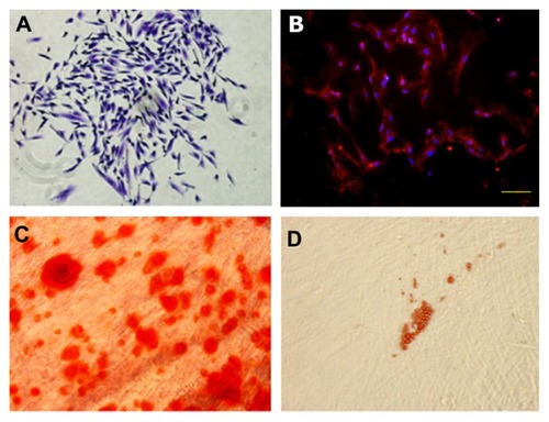 Figure 1 Characterization of PDLSCs. (A) Cell clusters derived from PDL formed a single colony and were stained with 0.1% toluidine blue, ×100. (B) Cultured PDLSCs exhibited positive staining for STRO-1 (×200) (STRO-1: red fluorescent signals; nuclei: blue signals). (C) After culture in osteogenic induction media for 4 weeks, cells formed minerals positive for Alizarin Red staining. ×400. (D) After culture in adipogenic induction media for 4 weeks, cells formed lipid vacuoles positive for Oil Red O staining, ×200.Abbreviations: PDLSCs, periodontal ligament stem cells; PDL, periodontal ligament.