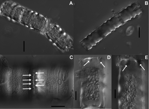Figure 2  Chain forming (A–C) and plastids (A,D,E) in Cavernosa kapitiana from Ile de la Possession. A–C, Chains linked by spines showing multiple plastids per cell. The arrows in C indicate the position of linking spines. D,E, Position of the caverns indicated by arrows. Note also the large number of discoid plastids. Scale bars, 20 μm (A,B), 10 μm (C–E).