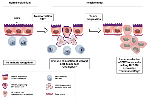 Figure 1. NKG2D-mediated immune response during the epithelial-to-mesenchymal transition. MHC class I polypeptide-related sequence (MIC)A/B are expressed on the apical surface of healthy colonocytes, and there is no evidence of a physical interaction between these molecules and natural killer group 2 member D (NKG2D), which is expressed by lymphocytes infiltrating the basal side of the epithelium and the lamina propria. This prevents the recognition of healthy cells by natural killer (NK) cells and hence the development of autoimmune responses. The expression of NKG2D ligands (NKG2DLs) is increased on the surface of malignant cells. Moreover, along with the loss of epithelial integrity and polarity that accompanies the so-called “epithelial-to-mesenchymal transition” (EMT), MICA/B can diffuse all over the plasma membrane of mesenchymal cells, leading to their elimination by NK cells. Only malignant cells that evolve mechanisms to circumvent NKG2D-mediated immune responses, such as the repression of NKG2DLs, are able to establish advanced lesions and metastases.