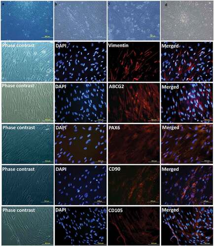 Figure 5. Expansion of Limbal Mesenchymal Stem Cells (LMSCs). Phase-contrast images of the cultured LMSCs on Day 3 (a) and Day 15 (b) of primary culture; end of passages 1 (c) and 2 (d). Phenotypic expression of LMSCs. The LMSCs show positive expression of the markers for mesenchymal-lineage: Vimentin, CD90 and CD105; and are also positive for stem cell markers ABCG2 and PAX-6.