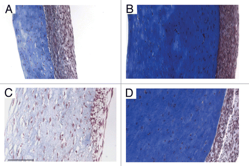 Figure 7 Masson's trichrome-stained TEVM sections. Representative sections of a control (A), TGFβ1-treated (B), TNFα-treated (C) and combined treatment (D) TEVM are shown demonstrating differences in wall thickness, collagen density and cellularity of the outer layer. Scale bar represents 100 µm and is applicable to all panels.