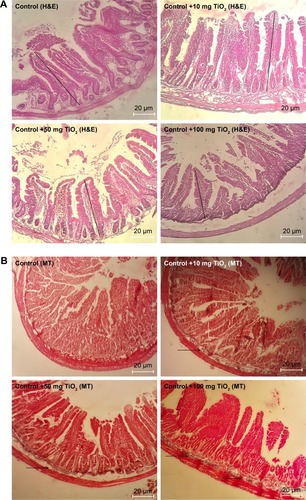 Figure 5 Morphological alteration of intestine.Notes: Effects of TiO2 NPs on histological changes of intestine determined by H&E (A), and MT staining (B) (magnification, 400×). Results showed that in TiO2 NP-treated groups crypt structure is injured and mucosa is eroded. Moreover, edema, necrosis, disruption, shortening, and loosening of intestinal villi are present. Arrow indicates collagen deposition and straight line shows villi altitude.Abbreviations: MT, Masson’s trichrome; TiO2 NPs, titanium dioxide nanoparticles; H&E, Hematoxylin and Eosin.