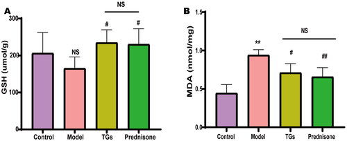 Figure 4. TGs inhibit renal oxidative stress in NS. (A) Levels of GSH in renal tissue homogenate. (B) Levels of MDA in renal tissue homogenate. (n = 5–6). Significance between groups was determined by ANOVA followed by Dunnett’s T3. Model group vs. Control group (**p ≤ 0.01, and NS p > 0.05); TGs group or Prednisone group vs. Model group (#p ≤ 0.05 and ##p ≤ 0.01); TGs group vs. prednisone group (NS p > 0.05).