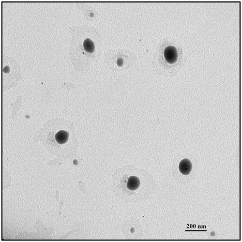 Figure 4. TEM image of VRS-NLCs.