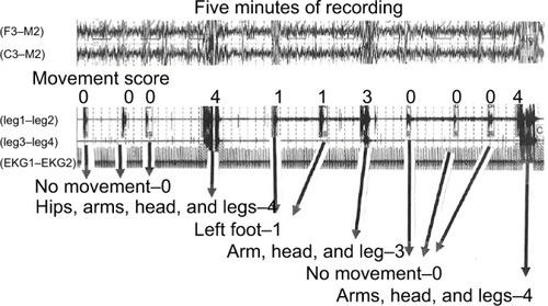 Figure 2 This is an example of the variations in the observed level of identified in some individuals.