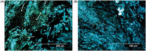 Figure 1. Surface of rat colon mucosa with mucus in CV- and GF-reared animals. (A) CV rat colon mucosa with evidence of bacteria (also evidenced in circle and by arrows). (B) GF rat colon mucosa with no evidence of bacteria. Confocal microscopy was performed on fresh samples using RM imaging. Original magnification = 43X.
