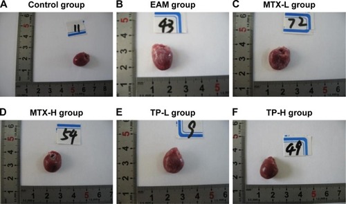 Figure 3 Macroscopic observation in rats for each group.Notes: (A) In the control group, the surface of the heart is smooth, with no inflammatory lesions. (B) In the EAM group, the heart became obviously larger and looked gloom, with some gray lesions distributed in a dispersed manner. (C) In the MTX-L group, the enlargement of the heart was reduced and the gray lesions on the surface also decreased significantly. (D) In the MTX-H group, the enlargement of the heart reduced and the gray lesions on the surface decreased significantly or even disappeared. (E) In the TP-L group, the enlargement of the heart reduced and the gray lesions on the surface also decreased significantly. (F) In the TP-H group, the enlargement of the heart reduced and the gray lesions on the surface decreased significantly or even disappeared.Abbreviations: EAM, autoimmune myocarditis; H, high dose; L, low dose; MTX, methotrexate; TP, triptolide.