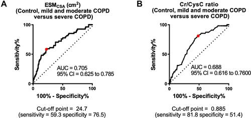 Figure 4 Receiver operating characteristic (ROC) curves and areas under the ROC curves (AUCs) of Cr/CysC and ESMCSA. The ROC curve and AUC of ESMCSA for severe COPD. The cut-off point of ESMCSA for severe COPD is 24.65 (AUC 0.705 (95% confidence interval [CI] 0.625–0.785), sensitivity = 59.3%, specificity = 76.3%) (A). The ROC curve and AUC of Cr/CysC for severe COPD. The cut-off point of Cr/CysC for severe COPD is 0.865 (AUC 0.688 (95% CI 0.616–0.760), sensitivity = 76.4%, specificity = 56.7%) (B).