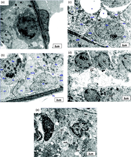 Figure 1.  Electronmicrograph of control, pairfed, and zinc deficient groups after 2 weeks. The scale bar = 2 µm. (A) Electronmicrograph of 2ZC group testes illustrating normal features of basement membrane (BM) showing basal lamina (bl), collagen fibres (cf), and endothelial cells (ed). Leydig cell nucleus (Nu) revealed characteristic peripheral heterochromatin (Hc). Presence of Type-A Spermatogonia (Sg) with its distinctive spherical nucleus and dense nucleolar body in association with the inner aspect of the nuclear envelope (Ne) is evident along with a large number of mitochondria (mt) with tubular cristae, rough endoplasmic reticulum (rER), ribosomes (r) and lysosomes (Ly) in the cytoplasm. (B) Electronmicrograph of 2PF group testes showing disrupted basement membrane (BM) with basal lamina (bl), collagen fibres (cf), and myoid cell process (My). Sertoli cell nucleus (Sc) exhibiting indentation and cytoplasm showing a large number of multivesicular bodies (mvb), lipid droplets (Ld), dilated smooth endoplasmic reticulum (sER), rough endoplasmic reticulum (rER), inter-Sertoli cell junctional complexes (Is), and parts of spermatocyte nuclei (Sp) with synaptonemal threads (St). (C) Ultrastructure of testes of 2ZD group testes displaying wavy basement membrane (BM) with basal lamina (bl), endothelial cells (ed), and disrupted collagen fibres (cf). Cytoplasm showing extensive vacuolization (V) and disruption of intercellular bridges (Icb), polyribosomes (pr), ribosomes (r), smooth endoplasmic reticulum (sER), rough endoplasmic reticulum (rER), abundant multivesicular bodies (mvb), and displaced Type A spermatogonium nucleus (Nu) showing chromatin conglomerates (Ch) with distinct nuclear envelope (Ne). (D) Ultrastructure of primary spermatocyte nuclei (Sp) of 2ZD group testes illustrating early apoptotic change viz. chromatin condensation (Cc) on the periphery. Extensive cytoplasmic damages with a large number of multivesicular bodies (mvb) are also distinct. (E) Electronmicrograph of 2ZD group testes illustrating juxtanuclear region of cytoplasm showing extensive vacuolization (V), dilated smooth endoplasmic reticulum (sER), and aggregation of multivesicular bodies (mvb). Peripheral heterochromatin (Hc) of Leydig cell nucleus (Nu) are evident.