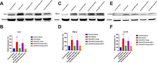 Figure 6 Effects of MTX combined with LBT on inflammation-related markers (n = 3). (A, C, E) representative Western blot bands of IL-6, TNF-α and IL-17A. (B, D, F) Quantitative analysis of the relative expression levels of IL-6, TNF-α and IL-17A. # p < 0.05, compared with Control +Vehicle; ## p < 0.01, compared with Control +Vehicle; * P < 0.05, compare with CIA+ Vehicle; ** P < 0.01, compare with CIA+ Vehicle.
