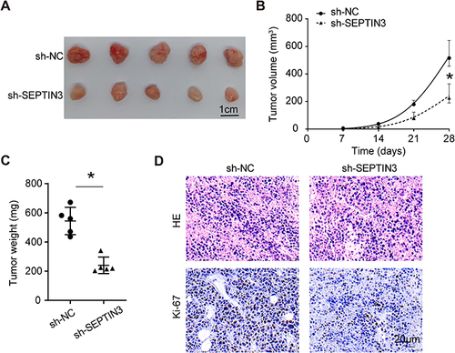 Figure 4 Knockdown of SEPTIN3 inhibited tumorigenicity of TNBC cells. (A) Xenograft images from TNBC cells with SEPTIN3 knockdown. (B) Tumor growth curves. (C) Tumor weight. (D) HE and IHC staining for xenograft. *P<0.05.