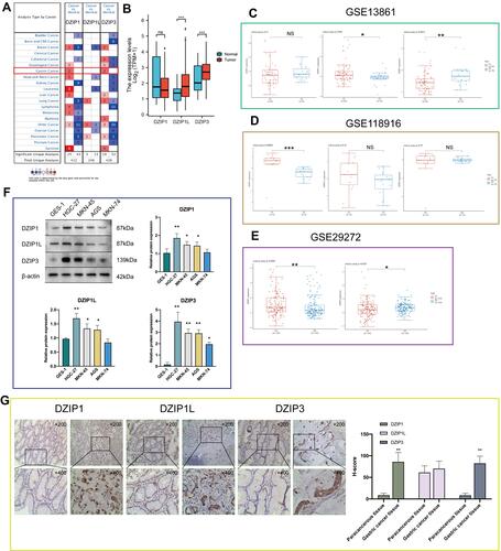 Figure 2 Expression levels of DZIPs in gastric cancer (GC) based on The Cancer Genome Atlas (TCGA)-STAD data. (A and B) Differences in DZIP expression between different types of human cancers. (C–E) mRNA levels of DZIPs in GC, examined using public datasets from Gene Expression Omnibus (GSE118916, GSE13861, and GSE292972). (F) Differential expression of DZIPs in normal gastric epithelial cells and GC cells. (G) Protein expression of DZIPs, examined using immunohistochemistry, in 15 pairs of GC tissue and adjacent normal tissue. *P < 0.05, **P < 0.01, ***P < 0.001.