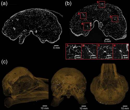 Figure 6. Ortho CT slices and rendered 3D models of the Oxford Dodo showing metal particles, characterised by star artefacts in the ortho slices, embedded within the bone of the skull, including deep within the trabecular bone. The metal particles are concentrated within the bone of the posterior left of the skull. (a) Coronal section through the cranial cavity, viewed from the posterior, with metal particles showing as bright spots; (b) Coronal section farther caudad than (a) showing a number of bright spots highlighted and enlarged to show the star artefacts and their position embedded deeply within trabecular bone; (c) 3D rendered images with the bone transparent and lead shot highlighted in white