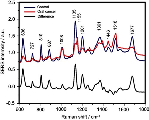 Figure S6 The mean surface-enhanced Raman scattering (SERS) spectra of serum from controls and oral cancer patients and their difference. The SERS spectra were acquired by focusing a 532 nm laser (10 mW) on the samples for 40 s. The SERS spectra were mean normalized and for each spectrum, two measurements were averaged