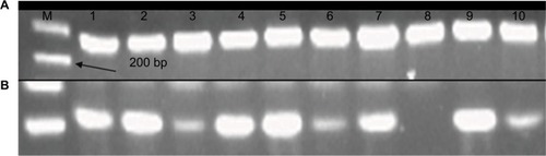Figure 3 mRNA products of RBBP6 in the form of cDNA following qPCR were analyzed using agarose gel electrophoresis. Lane A indicates normalization using GAPDH primer, and lane B indicates qPCR products obtained from 10 tissue samples.Abbreviations: M, DNA ladder marker; qPCR, quantitative PCR.