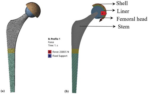 Figure 4. (a) Discretized hip implant model (b) Boundary conditions applied over the hip implant