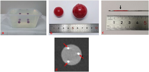 Figure 2. These photographs show the phantom models used to perform needle placement. (a) A phantom model consisted of colloid (colorless) and balls mimicking liver tumors (red). (b) A ball (20 mm in diameter) was used to perform a single-needle placement, and a ball (30 mm in diameter) was used to perform multiple-needles placement. Wrap the ball with film to prevent lopromide infiltration that may cause poor computed tomography (CT) scan. (c) The red stripe (arrow) inside the biopsy needle groove was a specimen after puncturing the center point of the ball. (d) A CT image after multiple-needles placement. The round, high echo was the largest coronal plane of the ball (30 mm in diameter) and the strong echo (arrows) were the points where the three needles passed through the largest coronal plane of the ball.