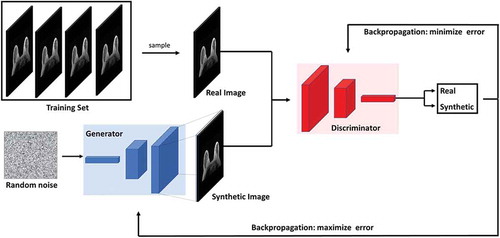 Figure 6. Illustration of the generative adversarial network (GAN) architecture. GANs consists of two neural network architectures competing against each other in a zero-sum game framework. One network generates candidates (generator) while the other evaluates them (discriminator). The goal of the generator is to synthesize realistic instances from the input data distribution while the goal of the discriminator is to differentiate between the true and synthesized instances of the input data distribution.