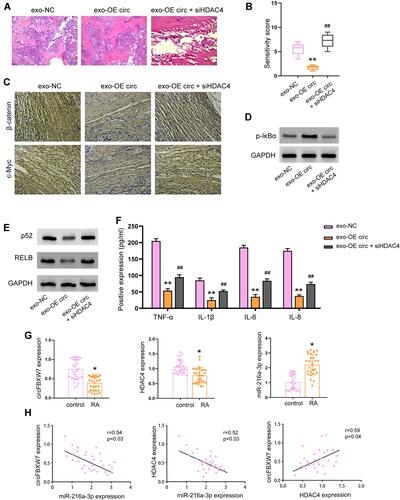 Figure 9 Knockdown of HDAC4 abolished the protective function of exosomal-circFBXW7 in RA model. The RA rat model was constructed and treated with exosomal circFBXW7 (exo-OE circ) or negative control (exo-NC), along with or without siHDAC4. (A and B) The pathological changes were analyzed by H&E staining. (C) The levels of β-catenin and c-Myc in synovium were measured by immunohistochemical staining. (D and E) The phosphorylation of IκB-α and the expression of p52 and RELB (E) were detected by Western blot assay. (F) The levels of TNF-α, IL-1β, IL-6, and IL-8 were checked by ELISA assay. ** P < 0.01. (G) Levels of circFBXW7, miR-216a-3p and HDAC4 in patients with RA was determined by qRT-PCR. (H) Correlation between circFBXW7, miR-216a-3p and HDAC4 was determined by Pearson analysis. * P < 0.05, ** P < 0.01 vs exo-NC, ##P < 0.01 vs exo-OE circ.