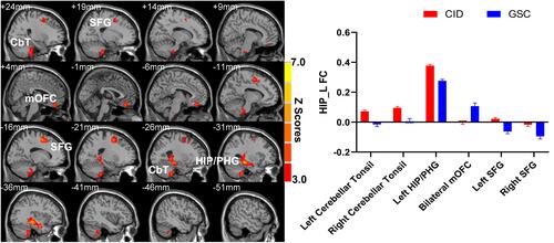 Figure 1 The main effect of diagnosis on the left hippocampus functional connectivity network.