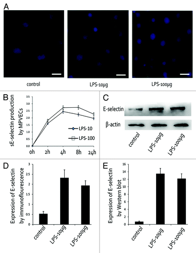 Figure 4. LPS induced E-selectin expression in MPVECs. (A and D) E-selectin expression in LPS-treated MPVECs detected by immunofluorescence. (B) Soluble E-selectin produced by MPVECs at different time point. (C and E) E-selectin expression in LPS-treated MPVECs detected by western blot.