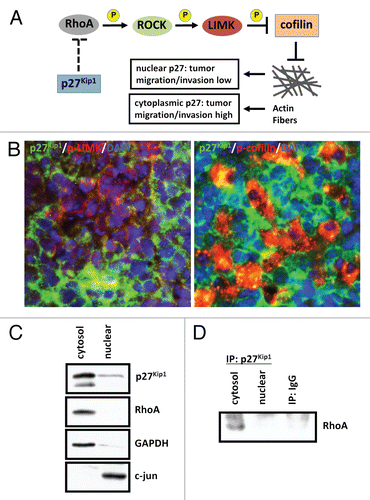 Figure 4 p27Kip1 plays a role in cell motility in SmoA1 medulloblastoma. (A) Schematic diagram of p27Kip1 regulating cell motility in tumor cells. (B) Immunofluorescence shows p27Kip1 is inversely correlated with stabilized cell motility, as evidenced by p27Kip1 (green), active phosphorylated-LIMK to prevent cell motility (red, left panel) and inactive phosphorylation of LIMK substrate and actin-depolymerization protein cofilin (red, right panel) in SmoA1 medulloblastoma. (C) Subcellular fractionation of SmoA1 medulloblastoma shows p27Kip1 and cell motility regulator RhoA are localized mainly in the cytoplasm. GAPDH serves as cytosolic control and c-jun as nuclear control. (D) Immunoprecipitation of p27Kip1 reveals interaction with RhoA. This data suggests p27Kip1 is needed to positively regulate cell motility in SmoA1 medulloblastoma.