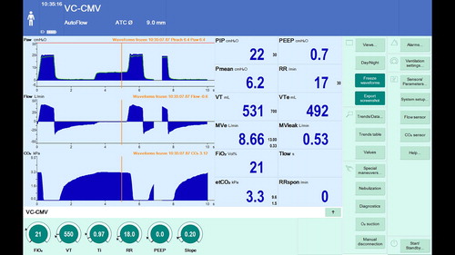 Figure 2. Measurement of intrinsic PEEP using an expiratory hold maneuver. It is possible to see that at set PEEP of zero the airway pressure at zero flow is 6.4 cm H2O indicating intrinsic PEEP.