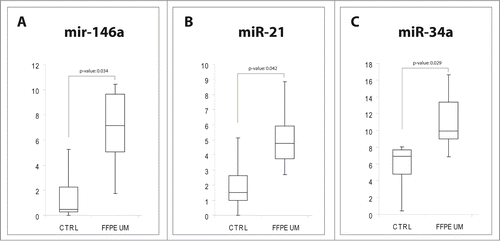 Figure 4. MiRNAs expression in FFPE UM specimens. Box plots representing the expression of: (A) miR-146a, (B) miR-21, (C) miR-34a, analyzed by single TaqMan assay on paraffin-embedded UM compared to healthy choroidal melanocytes. y-axis represents the −ΔCt of miRNAs in UM patients with respect to normal controls. Statistical significance was evaluated by the Wilcoxon rank sum test (p-value < 0.05).