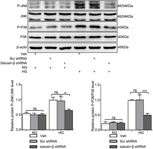Figure 9 Salusin-β knockdown inhibited the JNK and P38 MAPK pathways activated by HG in HRECs. After adenovirus-mediated transduction of shRNA against salusin-β or scrambled shRNA for 24 h, HRECs were cultured in HG medium for 48 h, and then the levels of p-JNK, JNK, p-p38 and p38 were analysed by Western blotting. n=3. **p<0.01, ****p<0.0001.