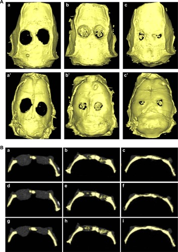 Figure 8 Micro-computed tomography scanning detection.Notes: (A) Micro-computed tomography (micro-CT) scanning shows the morphology of the regenerated bones: the control group (a and a’), the paper-stacking membranes group (b and b’), the adipose-derived stem cell (ADSC)-laden paper-stacking membranes group (c and c’); a, b, and c are the outside–inside view; and a’, b’, and c’ are the inside–outside view. (B) Micro-CT scanning shows the coronal view of the samples in the three groups in three different section planes: a, d, and g are different section planes of the control group; b, e, and h are different section planes of the paper-stacking membranes group; and c, f, and i are different section planes of the ADSC-laden paper-stacking membranes group. (C) Bone mineral density (BMD) of regenerated bone in the defect site in the control group, paper-stacking membranes group, and ADSC-laden paper-stacking membranes group. **P<0.05, ***P<0.01.