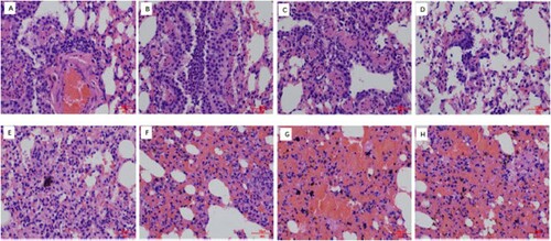 Figure 7. Histological lesions caused by H3N8 viruses in the lungs of ferrets. Ferrets were euthanized on 4 d.p.i. with 106 EID50 of test virus, and the lungs were collected for pathological study. The lungs of rT222 virus-inoculated animals showed only mild histopathological changes (H&E staining) (A-D), whereas the lungs of rT222-S524G(E-H), virus-inoculated ferrets showed severe pathological lesions (H&E staining). Images were taken at a 40×magnification.