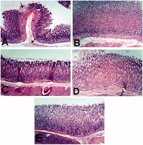 Figure 6. Stomach of rat treated with (A) indomethacin showing focal necrosis of gastric mucosa (small arrow) and submucosal edema (large arrow). BCO (B), COO (C), CLO (D), and control (E) control showing no histopathological changes (H & E x 100).