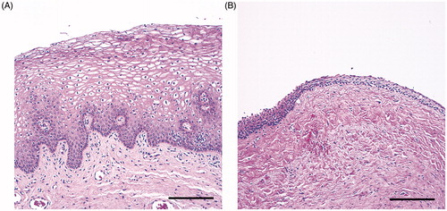 Figure 1. Hematoxylin-eosin stained biopsies from the vaginal wall in healthy women with thick squamous cell epithelia with dermal papillae (A), and cervical cancer survivors with thin epithelia and dense connective tissue with signs of fibrosis and elastosis (B). Scale bar = 200 μm.