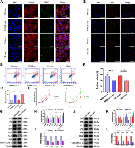 Figure 3 GDM-associated exosomes disrupted cell homeostasis and decreased the expression of lung surfactant proteins. (A) PKH67-labeled exosomes could be uptaken by A549 cells after incubated for 24h. Nuclei were counterstained with DAPI and the cytoskeleton was counterstained with phalloidin-iFluor 594. Scale bars, 100 μm. (B–L) A549 cells were treated with different groups exosomes (100 μg/mL) for 24 h. (B and C) The early apoptotic rate determined by flow cytometry analysis with annexin V and PI staining (n=5). (D) Cell viability analyzed by CCK8 assays (n=6). (E and F) Cell proliferation rate analyzed by EdU assays (n=6). Scale bars, 500 μm. (G and H) Western blot analysis of lung surfactant proteins A, B, C and D, BAX, BIM, BCL2, and cleaved CAS-3 expression in A549 cells treated with NUB-exos or GDMUB-exos for 24 h, quantified by signal intensity normalized to GAPDH (n=3). (I) Relative gene expression of lung surfactant proteins A, B, C, and D in the A549 cells treated with NUB-exos or GDMUB-exos for 24 h were measured by qRT‒PCR (n=9). (J and K) Western blot analysis of lung surfactant proteins A, B, C, and D, BAX, BIM, BCL2, and cleaved CAS-3 expression in the A549 cells treated with NC-exos or HG-exos for 24 h, quantified by signal intensity normalized to GAPDH (n=3). (L) Relative gene expression of lung surfactant proteins A, B, C, and D in the A549 cells treated with NC-exos or HG-exos for 24 h was measured by qRT‒PCR (n=9). *p < 0.05, **p < 0.01, ***p < 0.001, ****p < 0.0001.