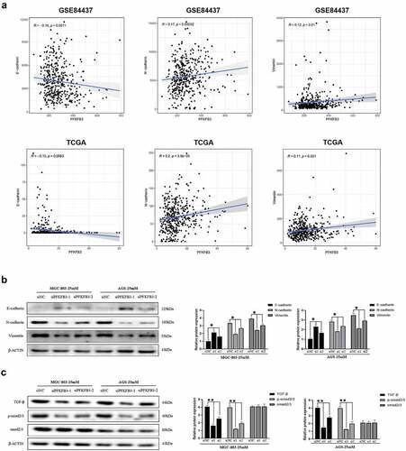 Figure 3. PFKFB3 silencing inhibited hyperglycemia-induced EMT and the TGF-β/Smad signaling pathway in AGS and MGC803 cells. (a) PFKFB3 expression was significantly correlated with EMT-related markers(E-cadherin, N-cadherin and Vimentin); (b) Western blot was performed to reflect the effects of PFKFB3 knockdown on EMT-related markers expression; (c) PFKFB3 knockdown was confirmed to inhibite the TGF-β/Smad signaling pathway with Western blot. *P < 0.05, **P < 0.01, ***P < 0.001