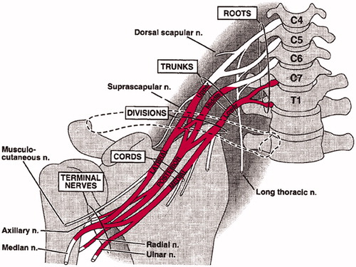 Figure 1. Anatomical definition and delineation of the brachial plexus. We used a modified version of the RTOG-contouring guidelines to delineate the inferior parts of the plexus, which are at risk for high absorbed doses at lung-SBRT. The delineated parts are marked with red and comprise the parts of the plexus in level with and inferior to C8, including the inferior trunk and the cords extending along the subclavian and axillary artery, a short fragment of the upper trunk running between mm scalenus anterior et medium, as well as parts of the proximal arm nerves distally to the plexus. Source: Ferrante MA [Citation16]. Wiley Periodicals, Inc.© 2004 Wiley Periodicals, Inc. Modified with permission