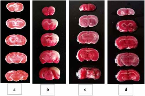 Figure 5. TTC staining results of rat brain tissue in each group.