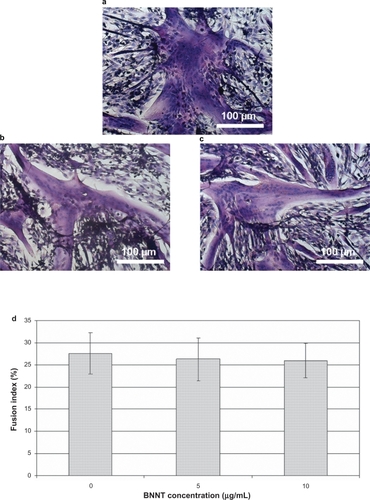 Figure 7 Light microscopy on H&E-stained cell samples showing myotube formation: differentiated C2C12 cultured with 0 (a), 5 (b), and 10 (c) μg/mL of PLL-BNNTs; fusion index evaluated for the three cultures (d).Abbreviations: BNNTs, boron nitride nanotubes; H&E, hematoxylin–eosin; PLL, poly-l-lysine.