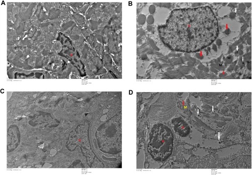 Figure 14 Transmission electron microscopy (TEM) images of different organs (A and B of Heart and C and D of lung) of Wistar rats treated with IONPs and control. (A) Control and (B) 30 mg/kg-treated group's ultrastructure of heart nucleus (N), mitochondria (M), nanoparticle deposition (white arrow), mitochondrial Cristae vacuolization (red arrow). (C) Control and (D) 30 mg/kg-treated group's ultrastructure of lung nucleus (N), mitochondria (M), nanoparticle deposition (white arrows), mitochondrial Cristae vacuolization (red arrows).