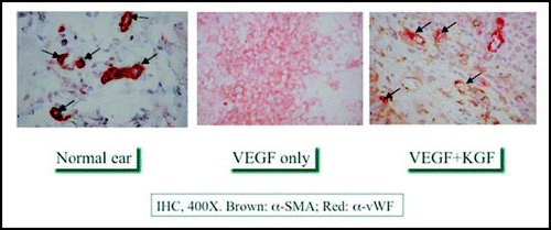 Figure 8 Mature vasculogenesis in mouse ear pinnae occurs with release of both KGF plus VEGF from Extracel™-HPG hydrogels (right) as compared to native vasculature (left), while VEGF-only hydrogels (middle) generate only immature leaky angiogenic sprouts.