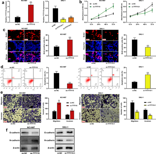 Figure 2. Effect of TTTY15 on GC cell proliferation, apoptosis, migration, invasion and EMT process. (a) The transfection efficiency of TTTY15 overexpression plasmid, si-TTTY15-1 and si-TTTY15-2 was detected by qRT-PCR. (b and c) CCK-8 method and BrdU assay were conducted for detecting the effects of TTTY15 overexpression and knockdown on the viability and proliferation of NCI-N87 and SUN-1 cells. (d) Flow cytometry assay was utilized for detecting the effects of TTTY15 overexpression and knockdown on the apoptosis of NCI-N87 and SUN-1 cells. (e) Transwell assays were performed to detect the effects of TTTY15 overexpression and knockdown on the migration and invasion of NCI-N87 and SUN-1 cells. (f) Western blot was carried out to detect the effects of TTTY15 overexpression and knockdown on the expression of EMT-related proteins in NCI-N87 and SUN-1 cells. All of the experiments were performed in triplicate. * P < 0.05, ** P < 0.01 and *** P < 0.001.