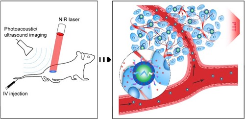 Figure 6 Schematic of the theranostic FA-PEG-PLGA-Ptx@ICG-Pfh NPs.Abbreviations: FA, folic acid; PEG, polyethylene glycol; PLGA, poly(lactide-co-glycolic acid); Ptx, paclitaxel; ICG, indocyanine green; Pfh, perfluorohexane; NPs, nanoparticles; NIR, near-infrared; IV, intravenous; PTT, photothermal therapy.