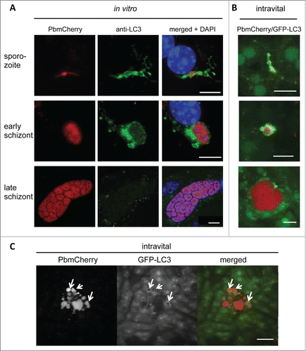 Figure 1. LC3-II is recruited to the vicinity of Plasmodium parasites in primary mouse hepatocytes. (A) Primary mouse hepatocytes were freshly isolated, seeded on coverslips, and infected with P. berghei that expressed mCherry fluorescent protein (PbmCherry). The infected cells were fixed at different developmental stages and stained with an anti-LC3 antibody and the DNA dye DAPI. Labeled scale bars are included at the bottom-right of the images. (B) In vivo LC3 dynamics in P. berghei-infected cells. A GFP-LC3-expressing mouse (green) was infected with mCherry-expressing P. berghei parasites (red) and analyzed by intravital imaging at different developmental stages, as indicated. (C) Intravital imaging of the same mouse that shows a dying parasite at the late developmental stage. The dispersed parasite vesicles show a transient but strong association with GFP-LC3. Scale bars: 10 µm. See also Movie S1.